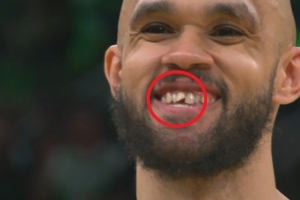 小白談去年總決賽被打門牙：之后我進(jìn)了三分 是我最美好回憶之一