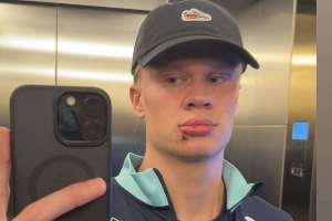 【小吧社交秀】哈蘭德帥臉慘遭“破相”  內(nèi)維斯女友青春甜美