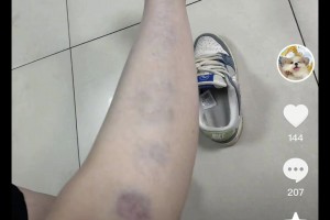 涉及籃球女主播？解說員孔祥宇妻子社媒曬家暴痕跡&申請離婚