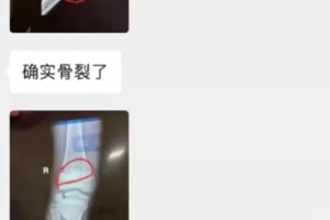 孫繼海無辜！你這媽不是因為孩子受傷才退出，而是去當?shù)氐木銟凡? >
                                        </div>
                                    </div>
                                                                        <div   id=